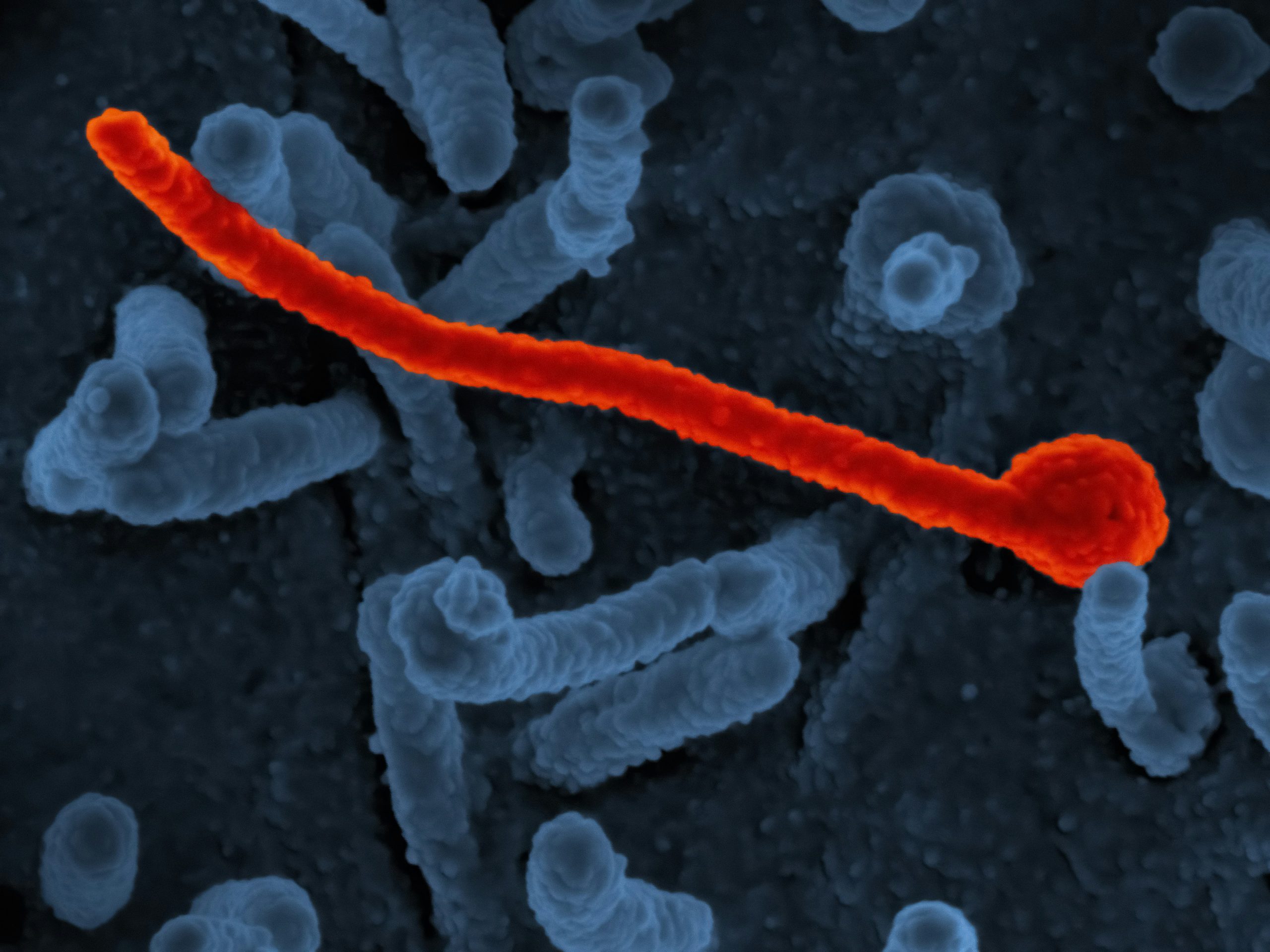 Dominican Republic strengthens airport health controls to prevent Ebola entry