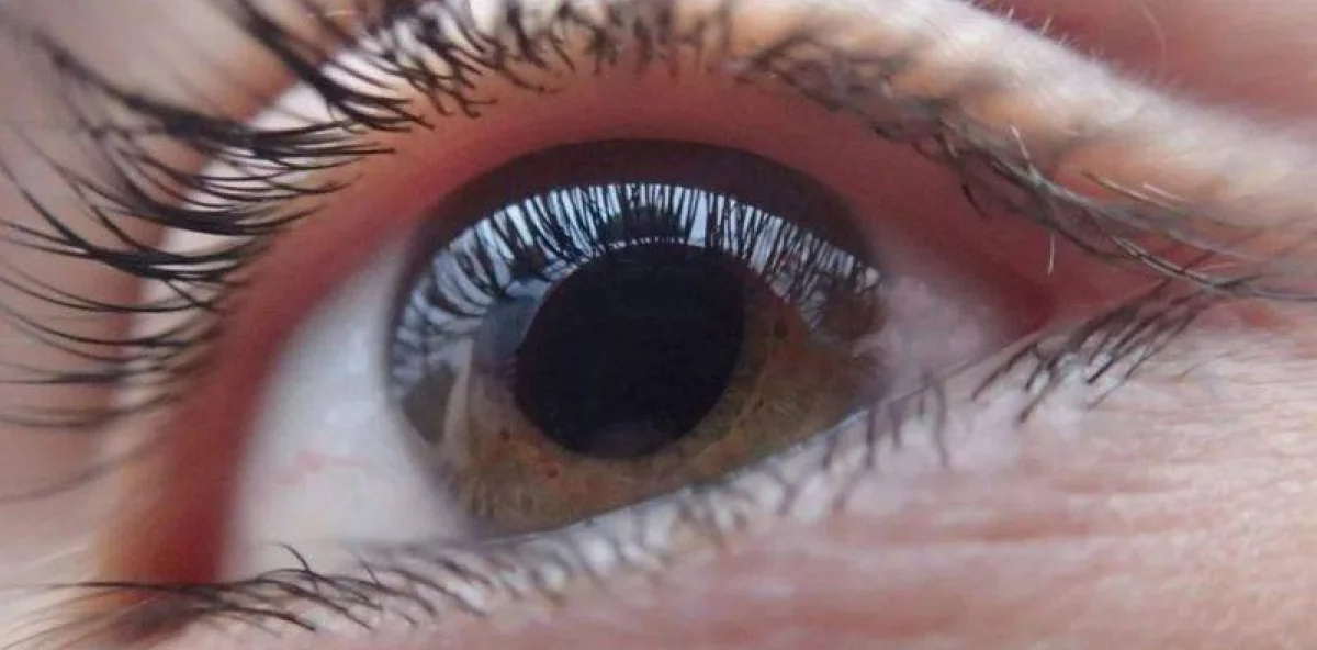 Retinitis Pigmentosa in Dominican Republic: Vision signs that should not be overlooked